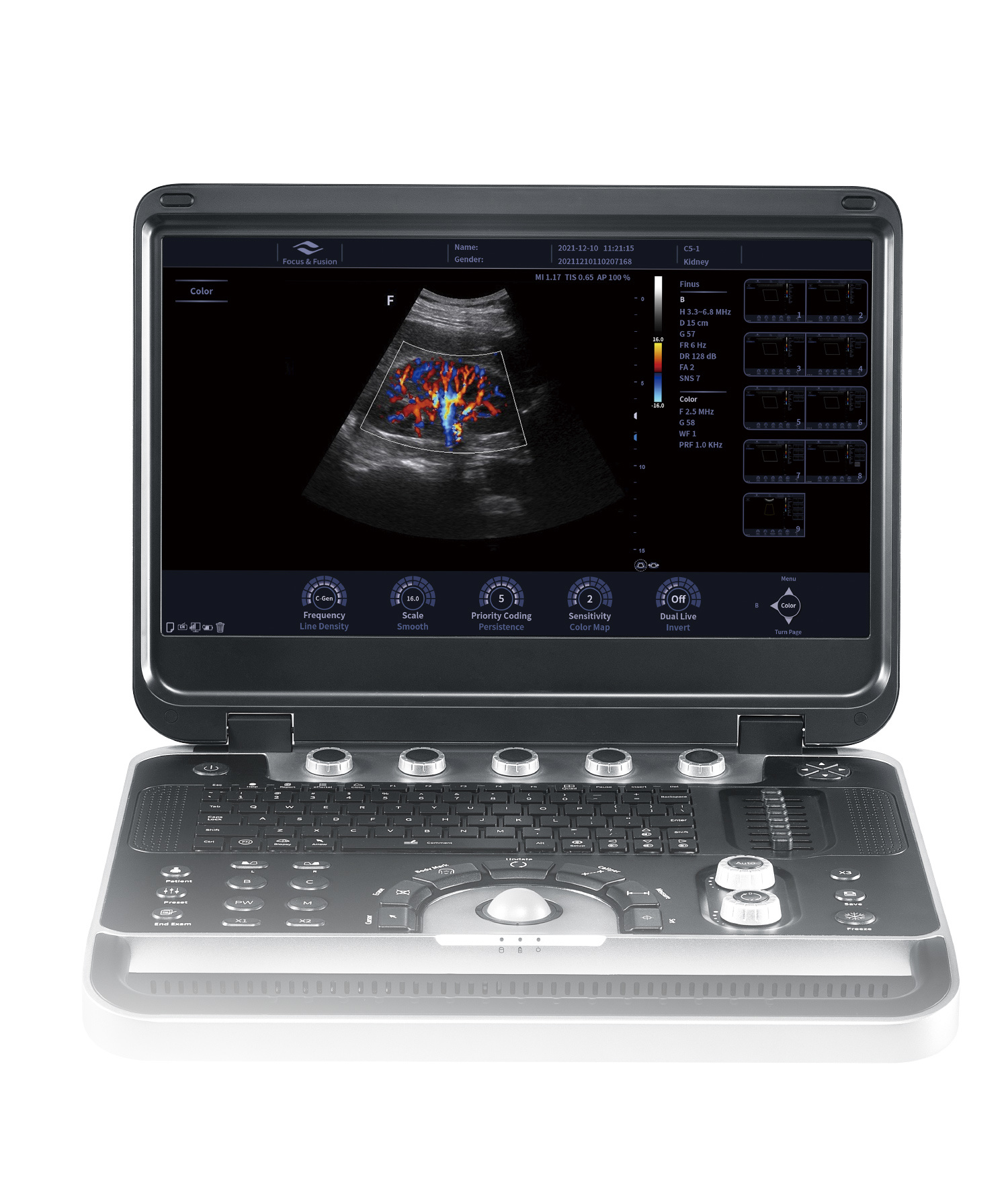 Focus & Fusion Finus 50
